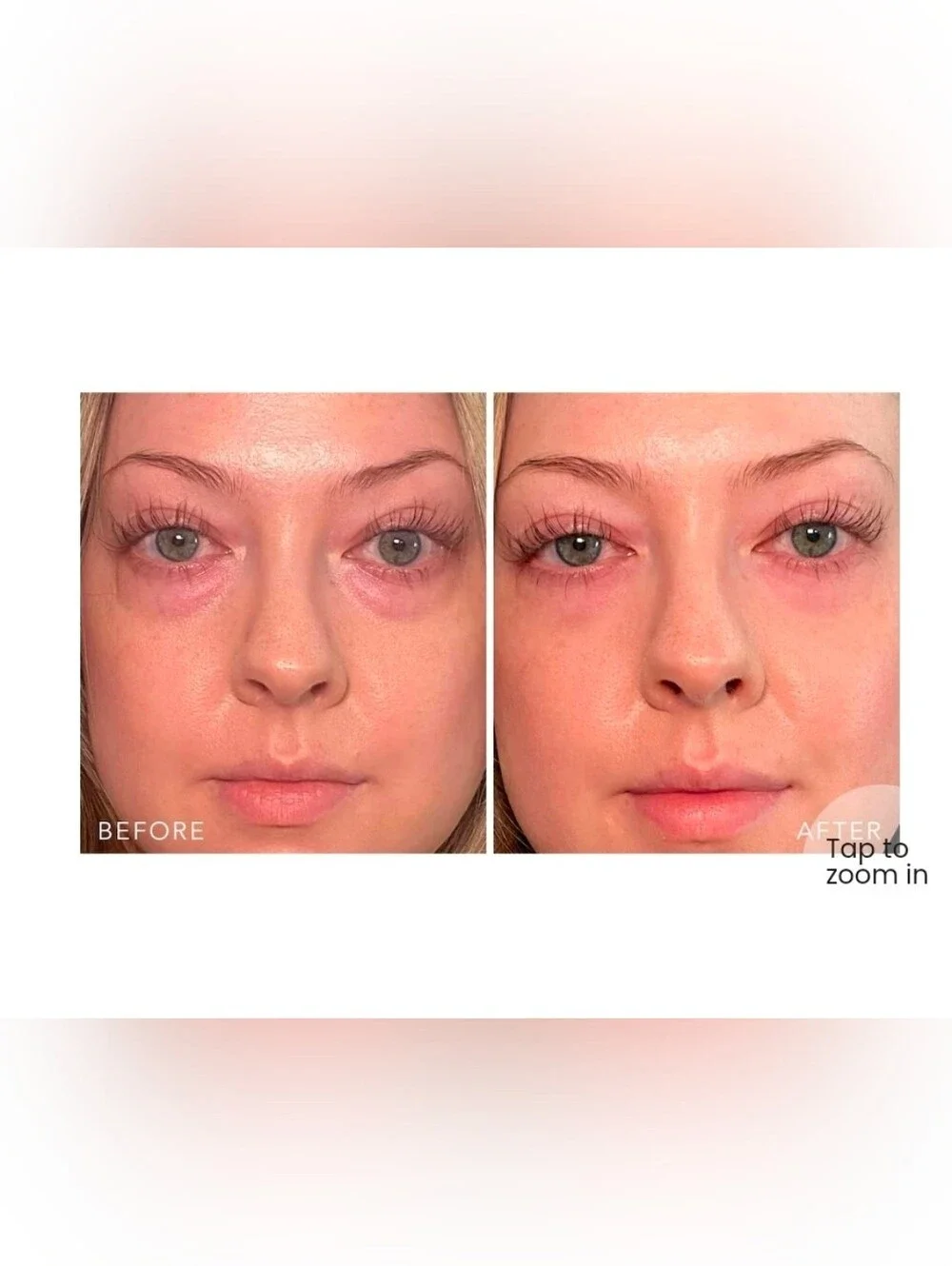 Doll 10 Insta-Tight Peptide Firming Eye Gel - 30ml/1fl.oz. - NWT